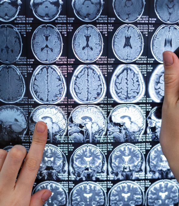 Neuro Surgery